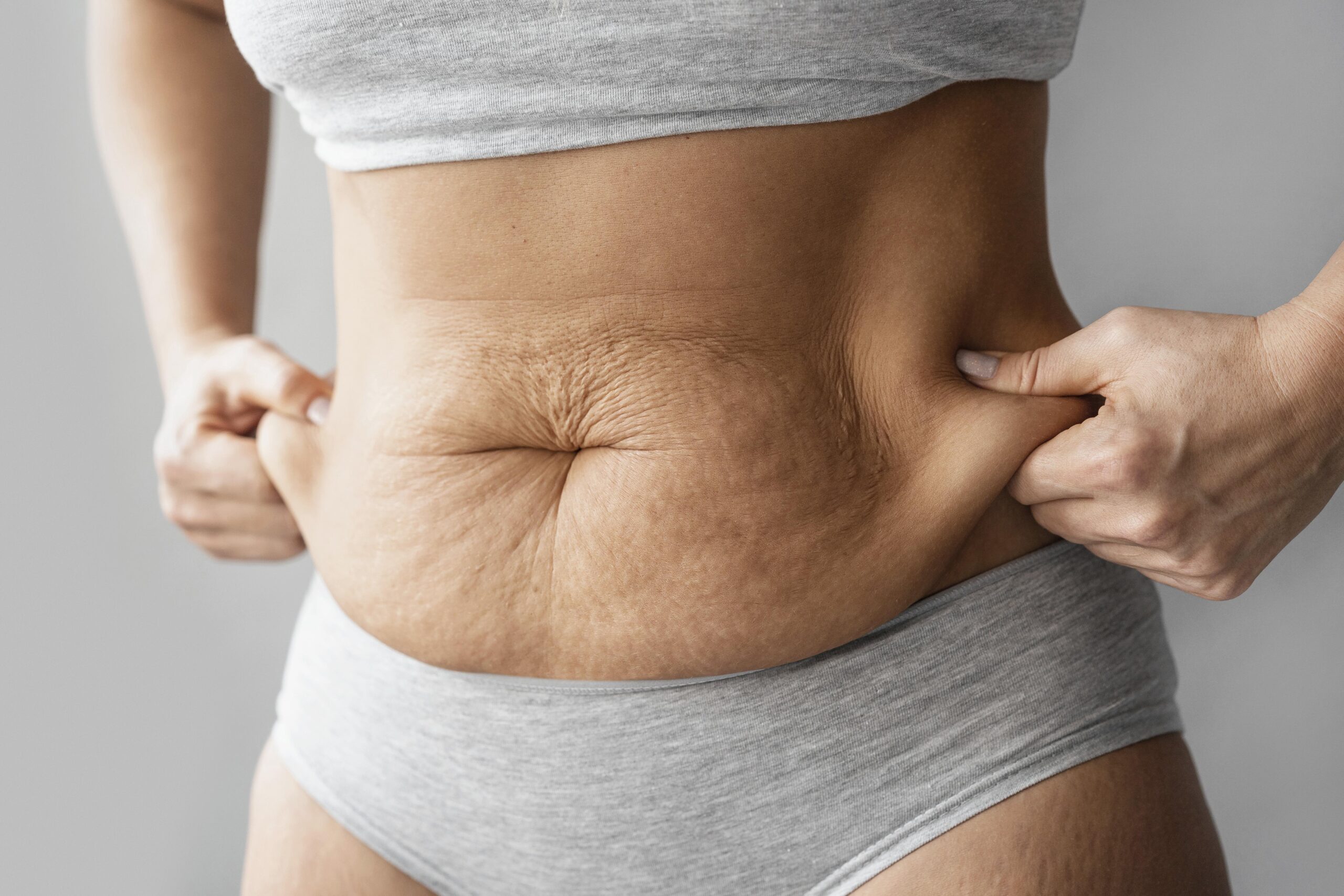 How to Tighten Skin After Weight Loss Naturally: Science-Backed 12 Methods for Firmer, Youthful Skin